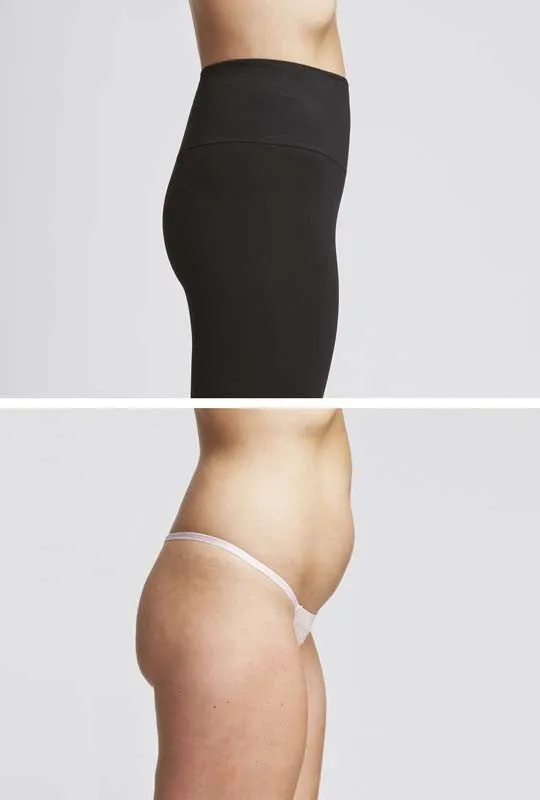 Extra Strong Compression Waisted Leggings with Egyptian Cotton Black